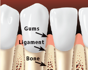 Gums, Ligament And Bone — Hudsonville, MI — Hudsonville Family Dentistry Gums, Ligament And Bone — Hudsonville, MI — Hudsonville Family Dentistry