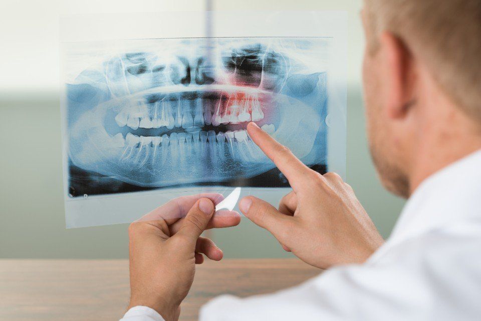 panoramica dentale
