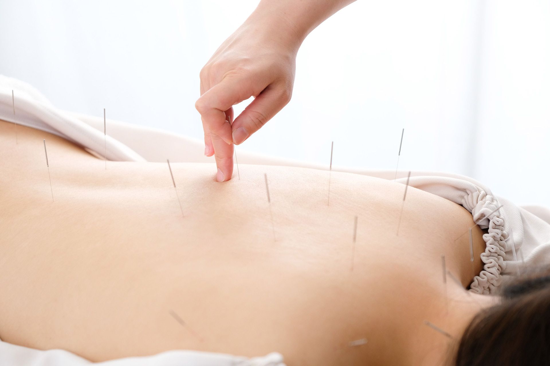 Restorative Acupuncture