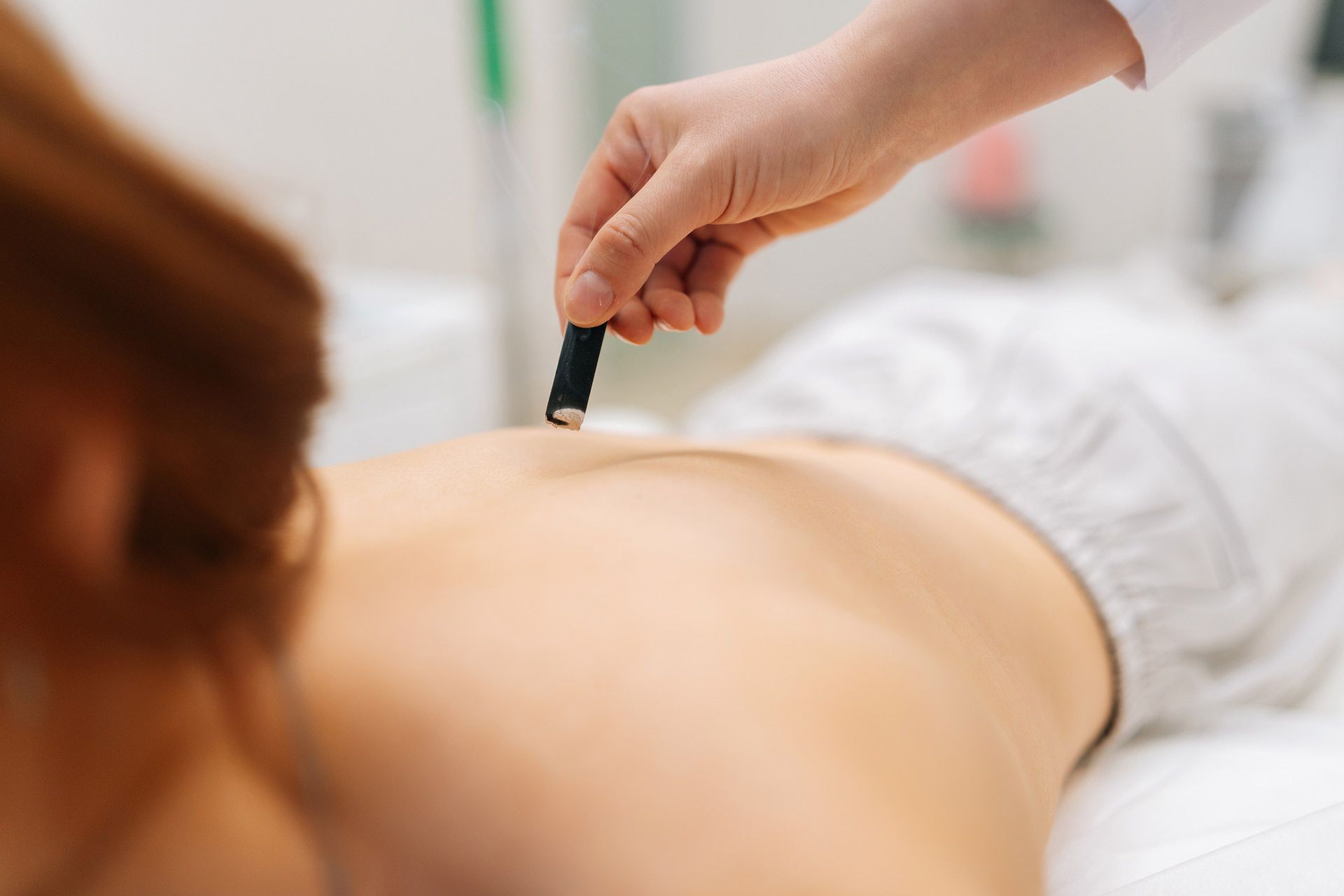 Chinese Moxibustion