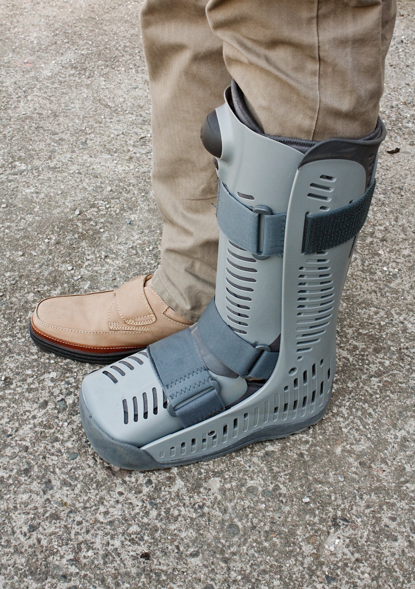 Foot Fractures — Brockton, MA — JW Podiatry