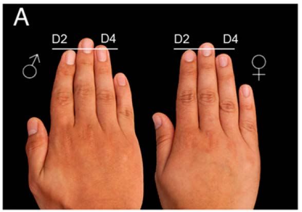 Male and female hands, with index (D2) and ring fingers (D4) indicated. Male hand's ring finger is longer.