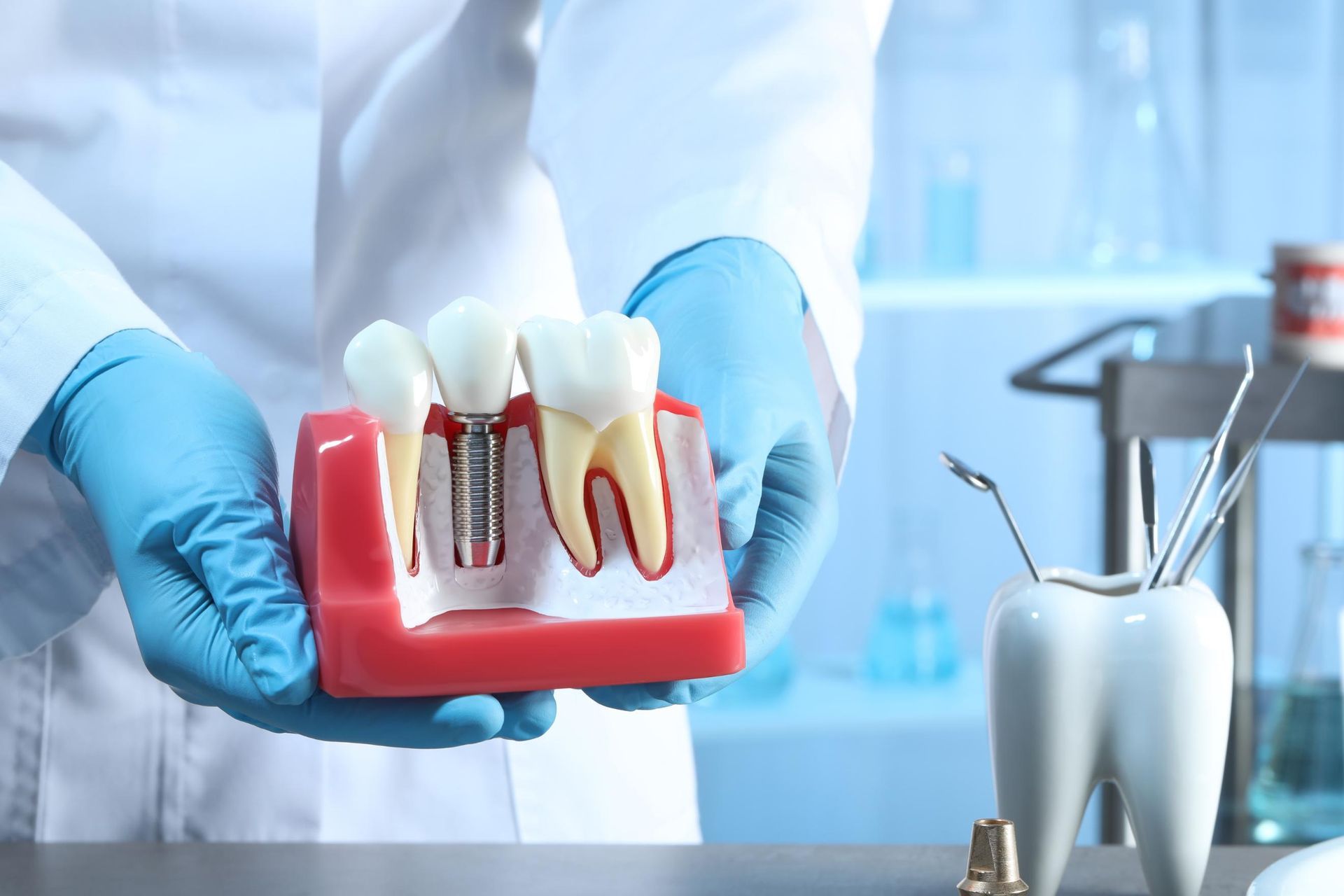 A dentist is holding a model of a dental implant in his hands.