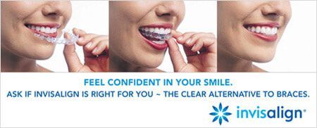 A woman is smiling with braces on her teeth.