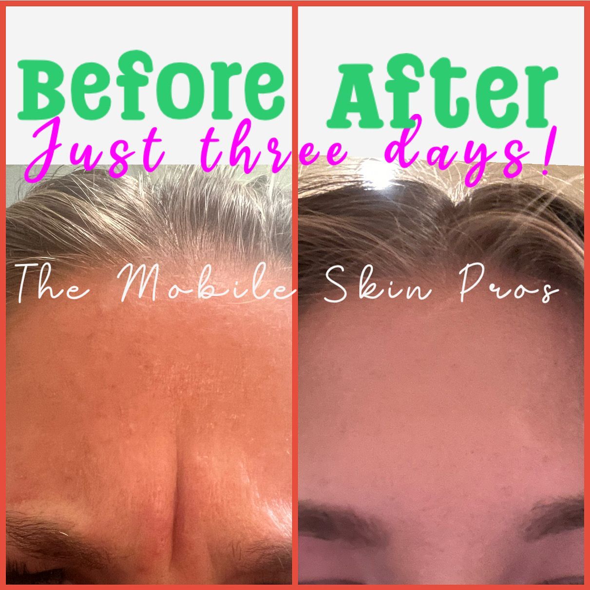 young girl who received botox to removed 