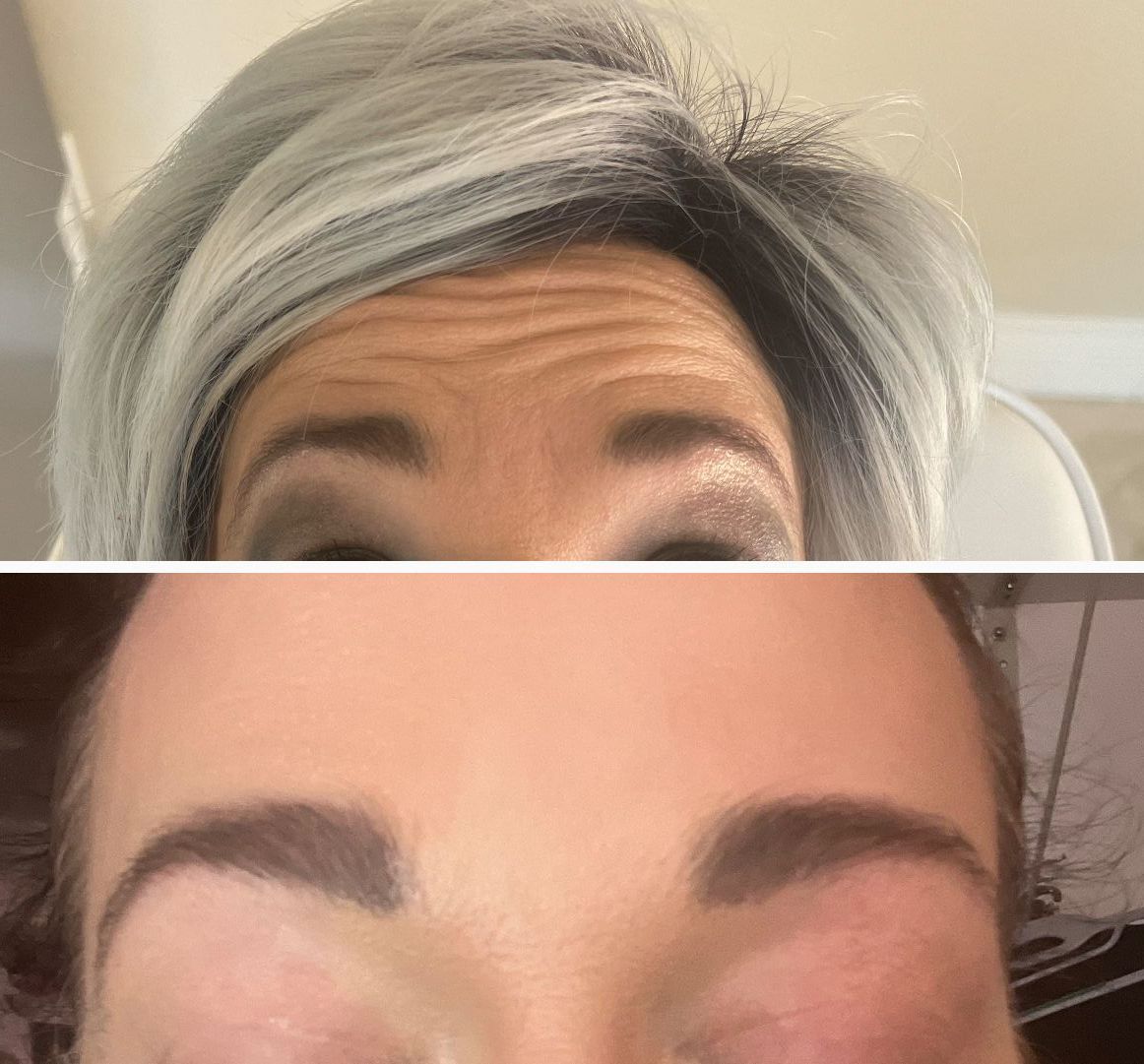 before and after to show her improvements