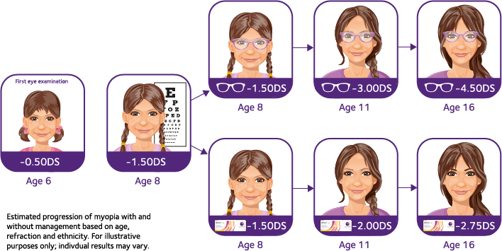 Myopia Management Image
