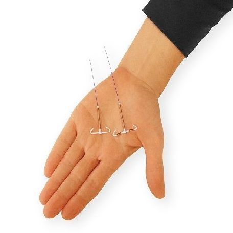 IUD in hand