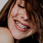 A woman with braces on her teeth is smiling with her eyes closed.