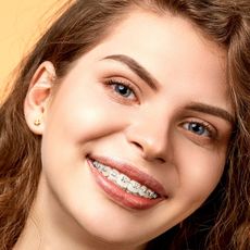 A close up of a woman 's face with braces on her teeth.