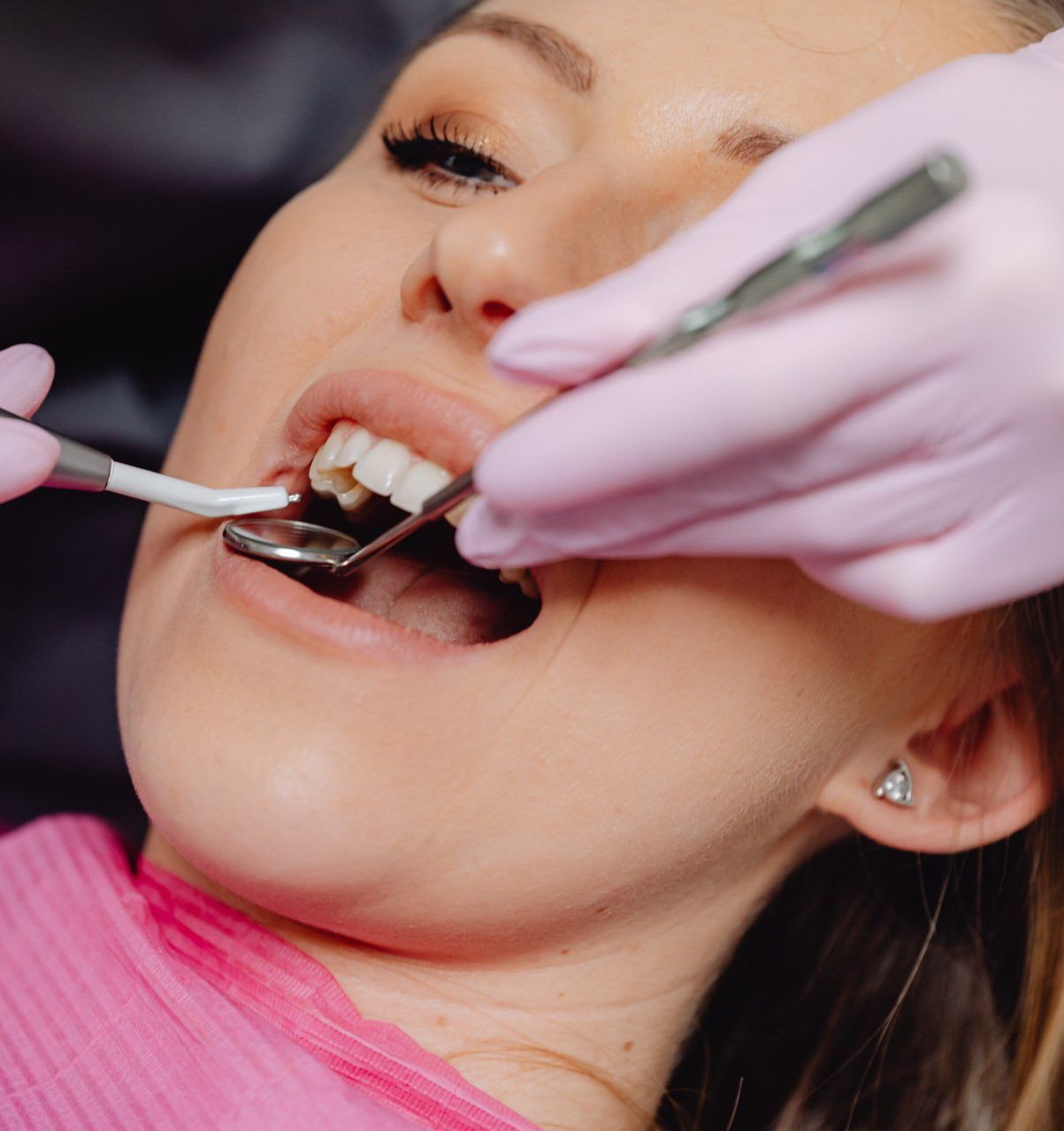A woman is getting her teeth examined by a dentist.