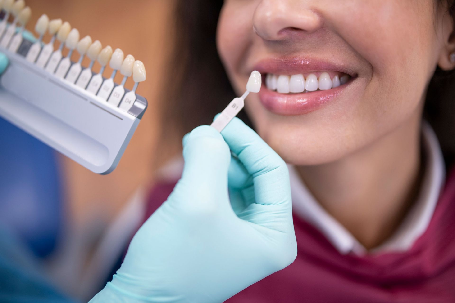 Dental Veneers — Belmont, VIC — Geelong Dental Group