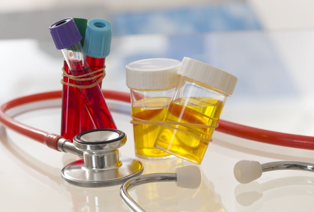 Medical Lab Scene With Stethoscope, Test Tubes of Blood, and Fluid Cups — HealthHub Taree in Taree, NSW