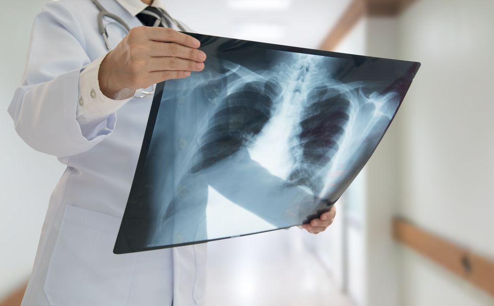 Doctor Holding a Chest X-ray in a Bright Hospital Hallway — HealthHub Taree in Taree, NSW