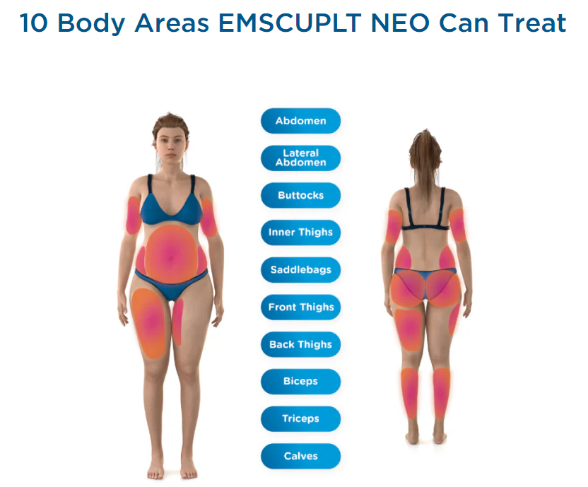 Diagram showing 10 body areas EMSCULPT NEO can treat, with front and back views of a woman. Pink highlight indicates treatment areas.