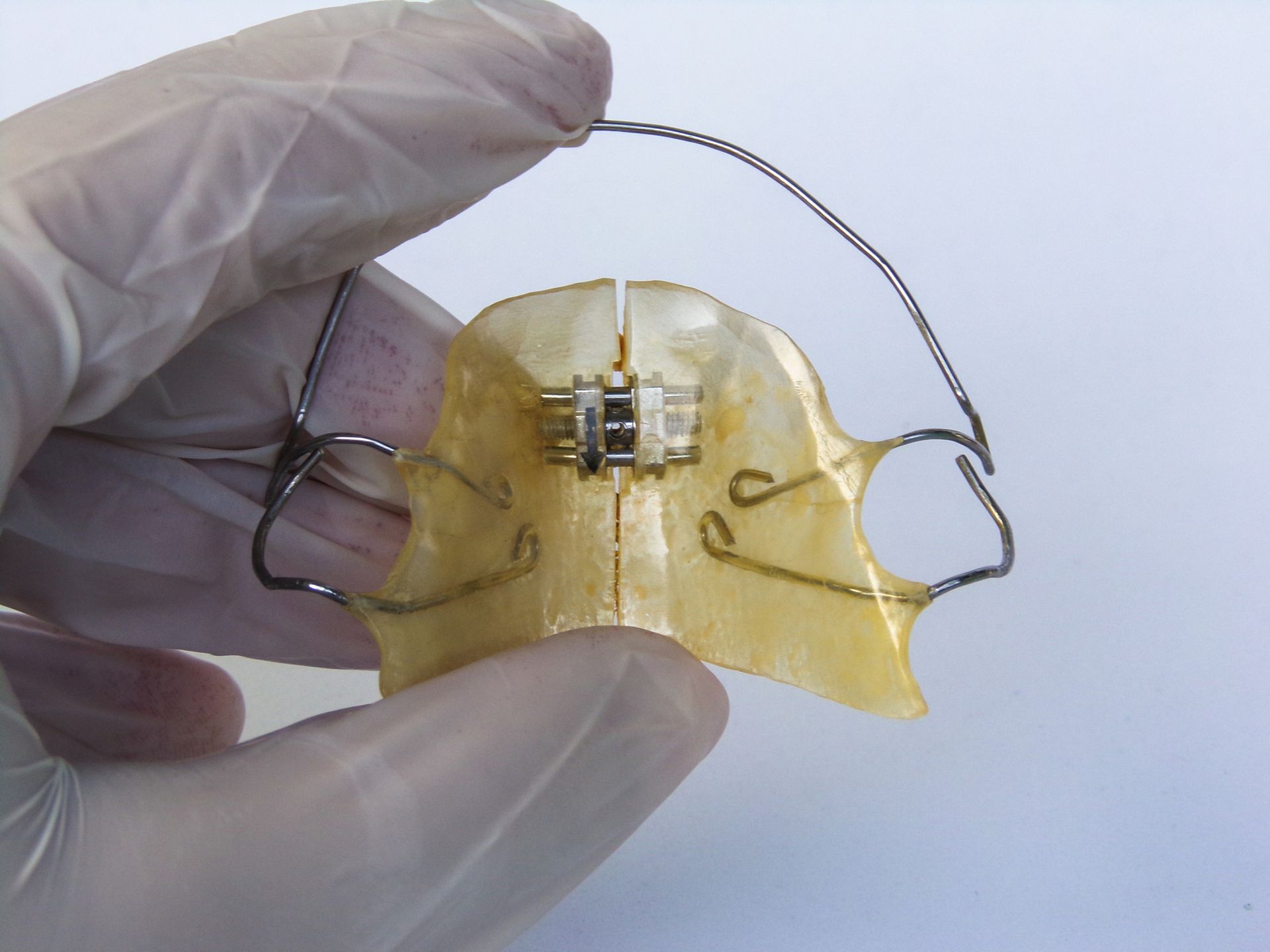 New Dental Retainers | Wollongong, NSW