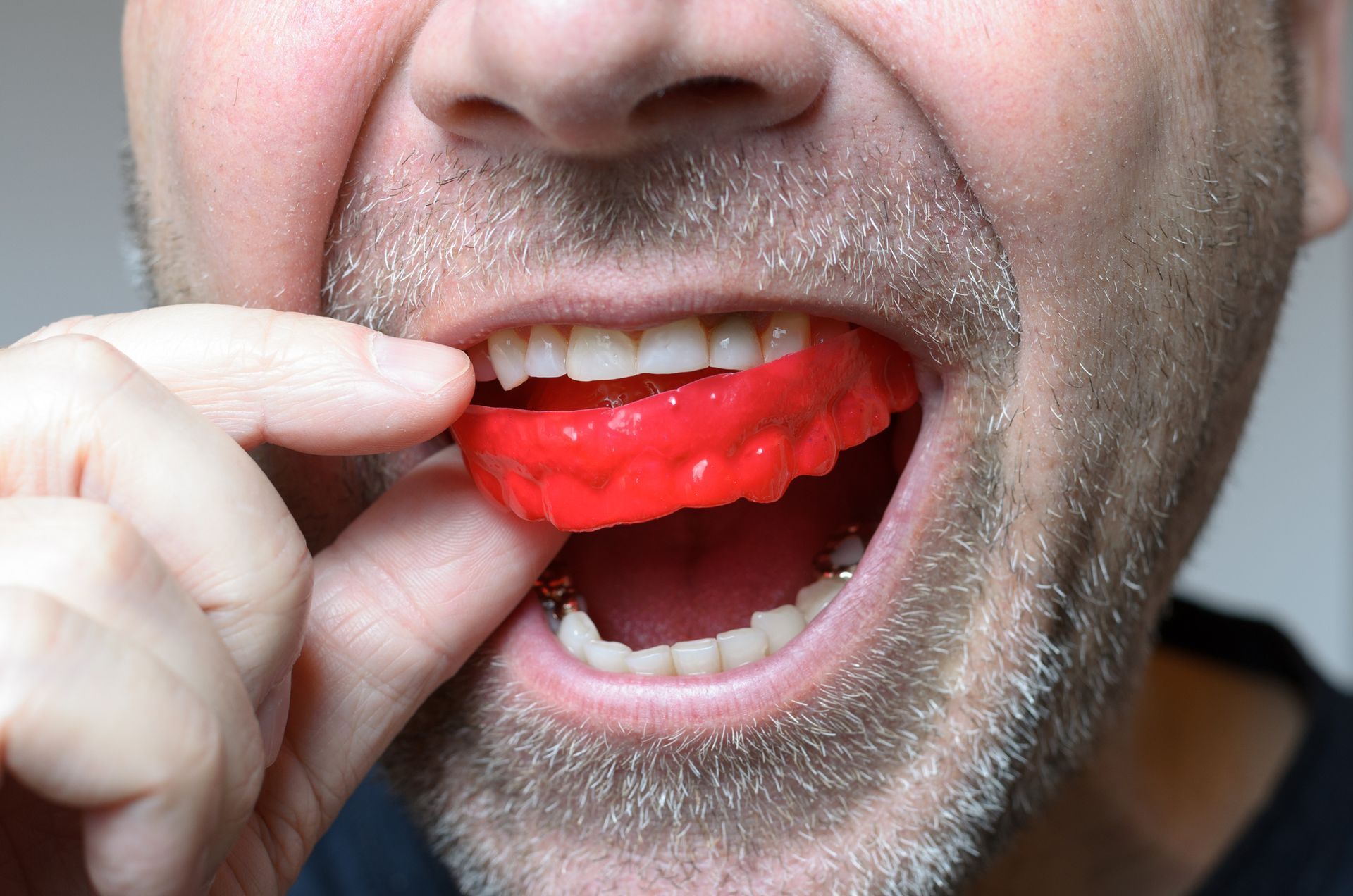 Man putting a red mouthguard in his mouth with his fingers.