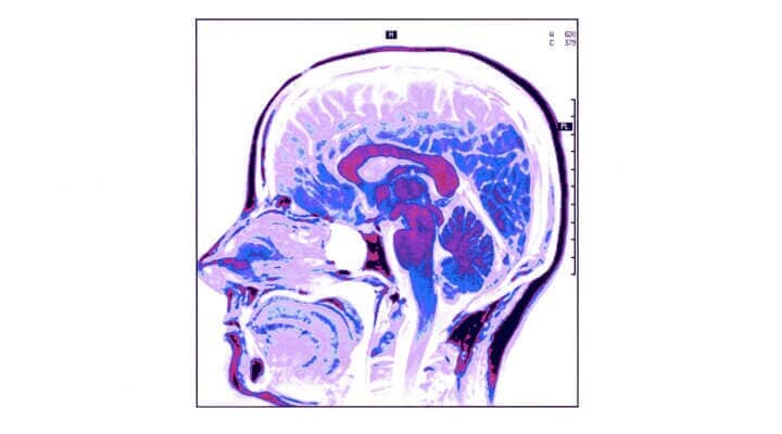 DR. ISIDRO PUENTE RAMÍREZ - ENFERMEDAD-DE-ALZHEIMER DR. ISIDRO PUENTE RAMÍREZ - ENFERMEDAD-DE-ALZHEIMER