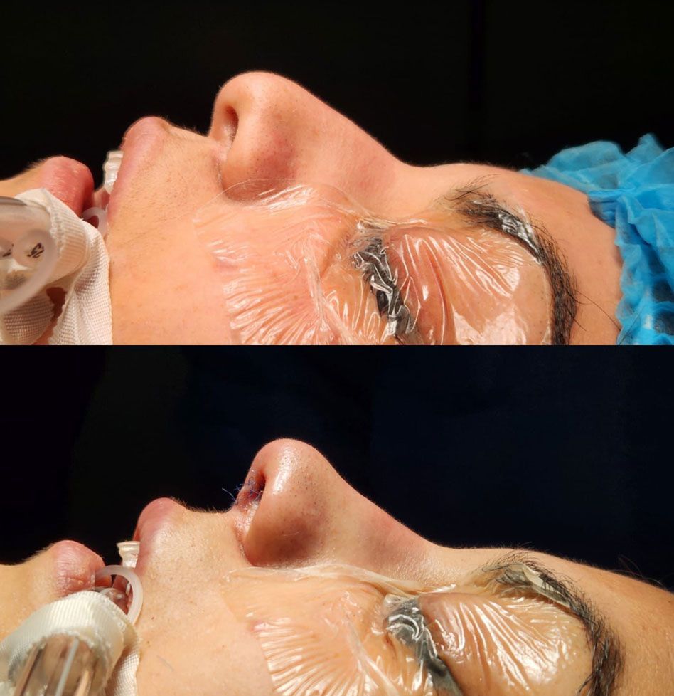 Dr. Fernando Vázquez - ENFERMEDADES DE LA GARGANTA