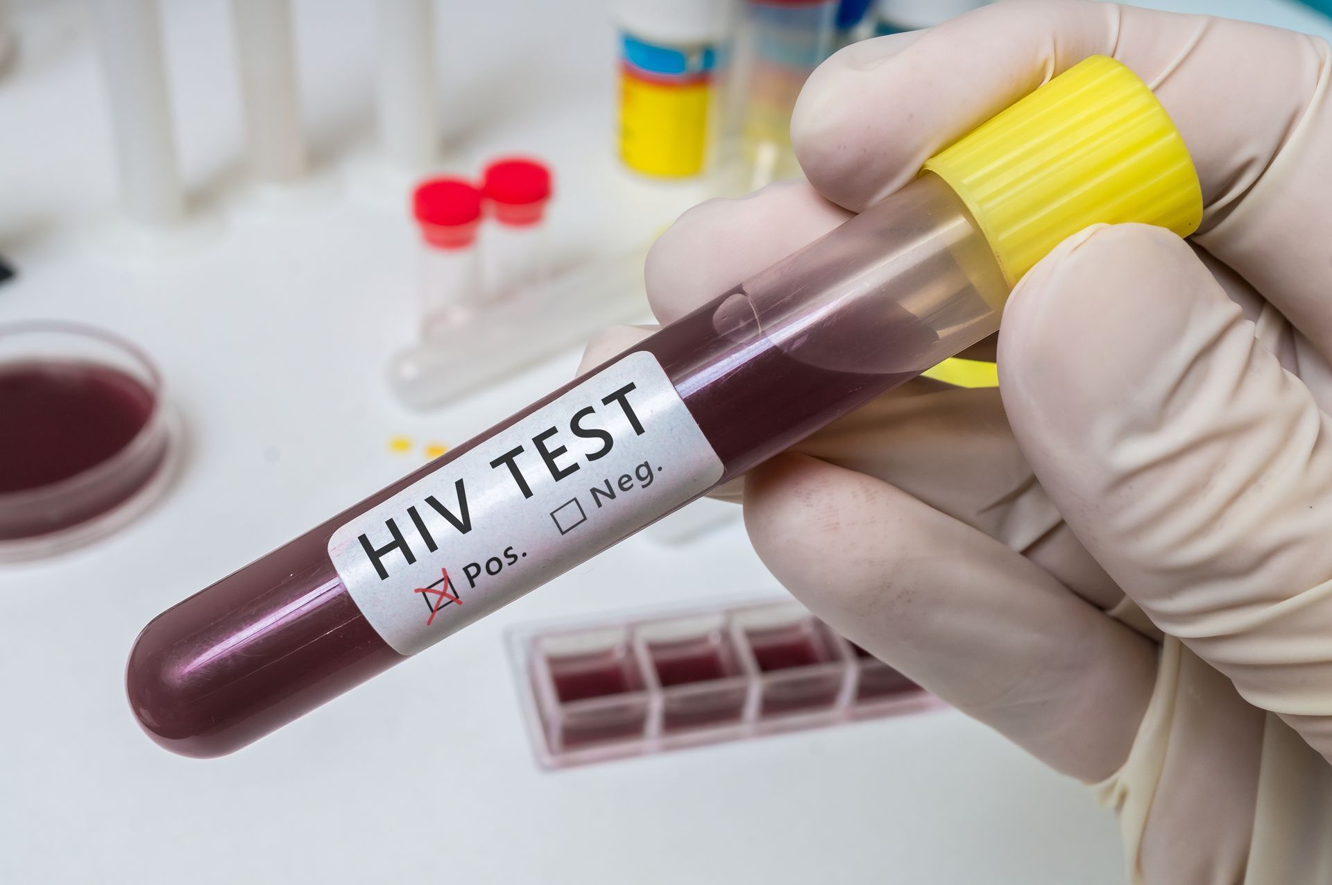 HIV & PrEP, Hautarzt Dr.med.univ. Michael Skoll, 1110 Wien