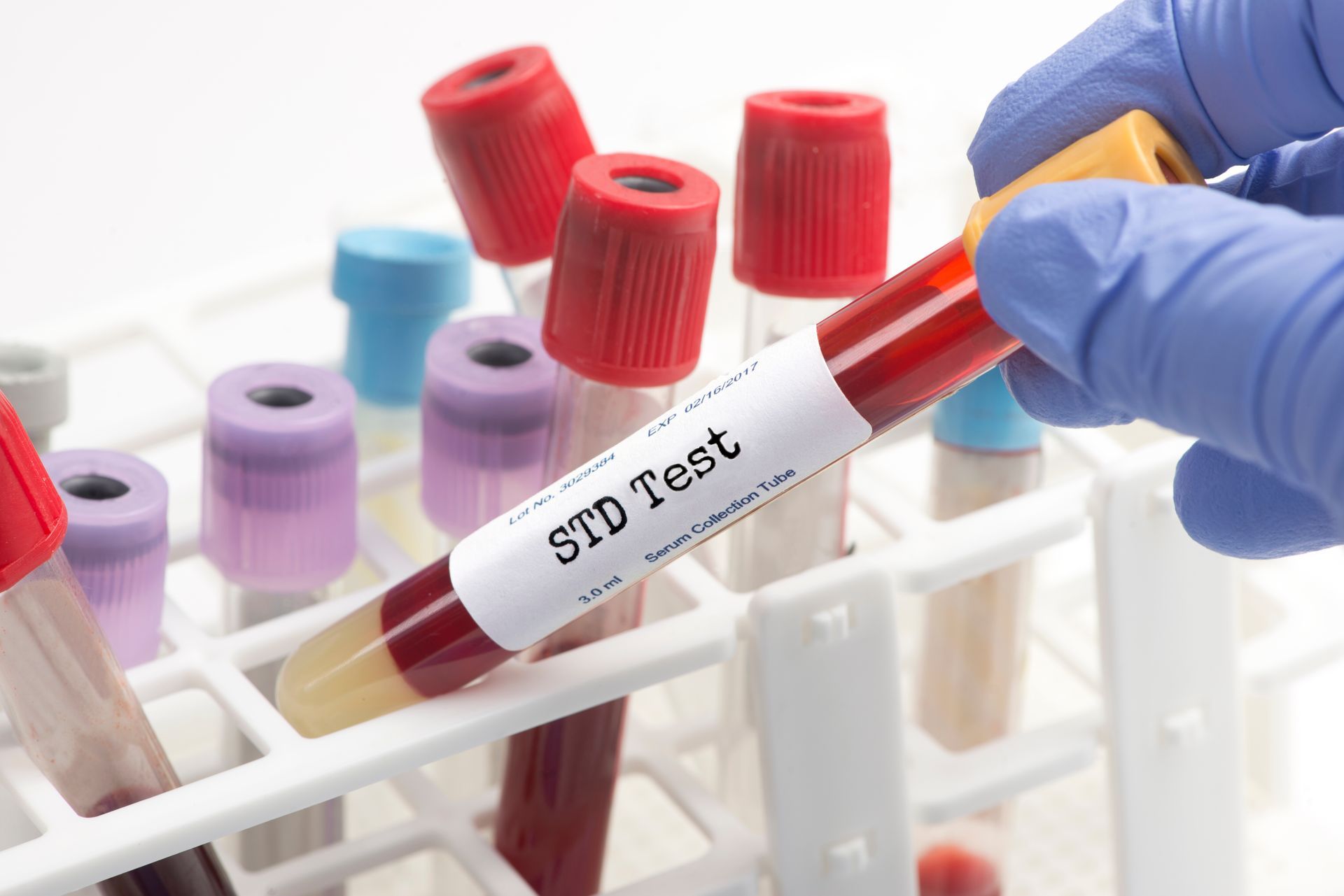Sexuell übertragbare Erkrankungen (STI, STD), Hautarzt Dr.med.univ. Michael Skoll
