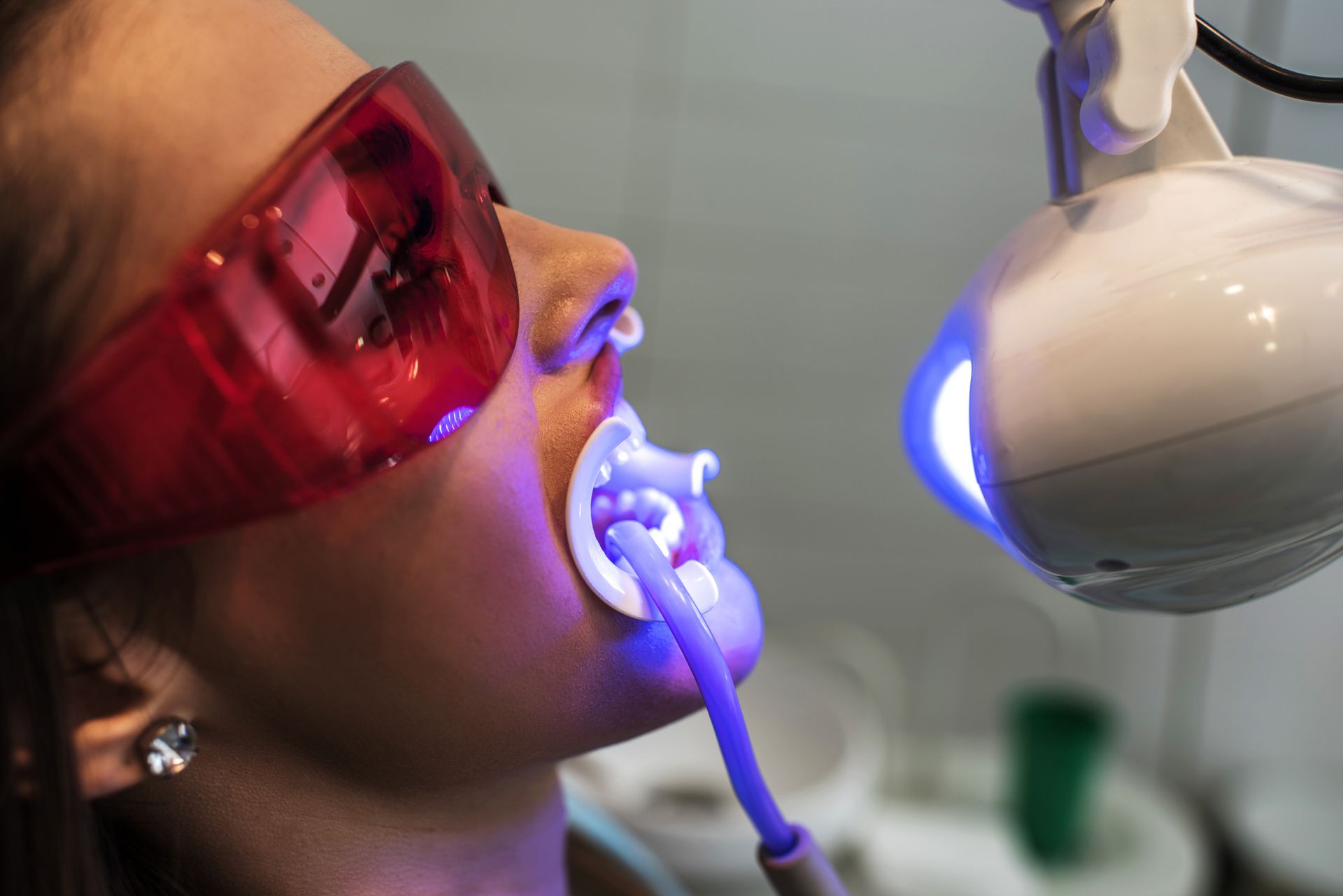 Cosmetic Dentistry Procedures Sarasota FL