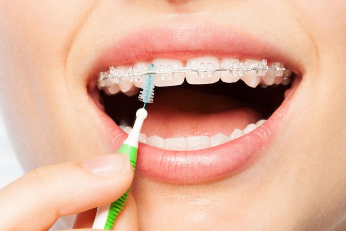 Benefits of Cosmetic Dentistry Sarasota FL Benefits of Cosmetic Dentistry Sarasota FL