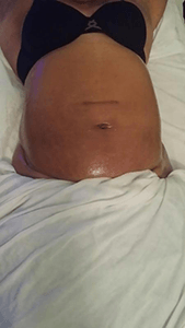 Belly tratment