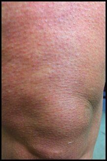 Skin texture