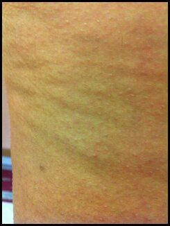 Skin texture