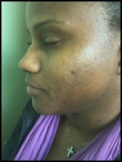 Side face