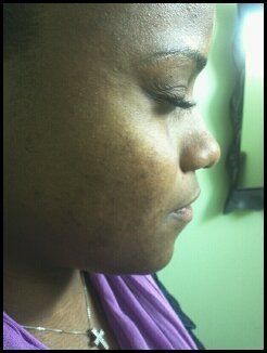 Side face