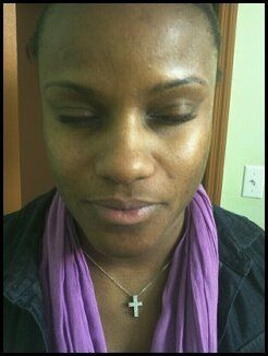 Front face