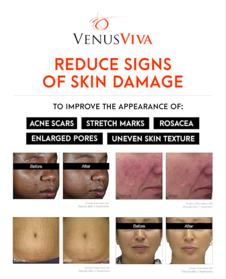 Skin damage banner