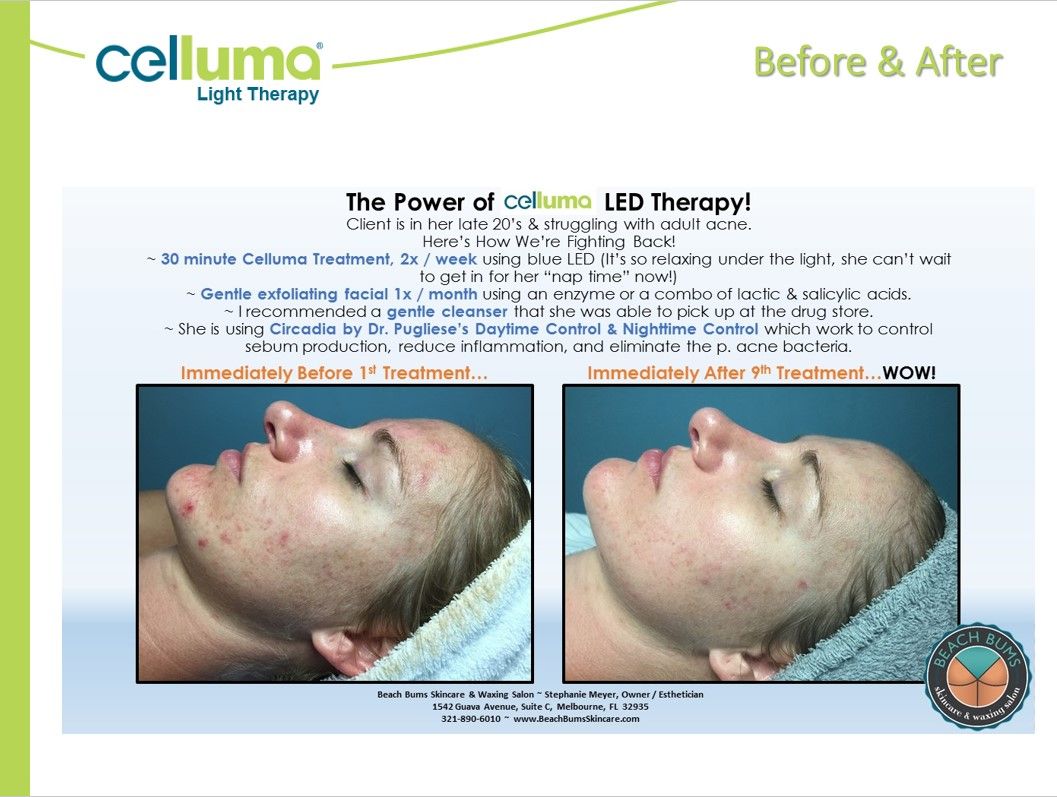 A before and after photo of a woman 's face