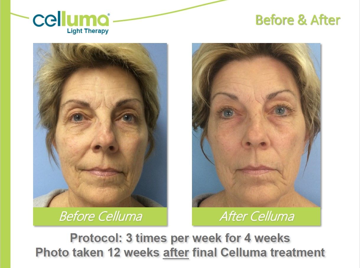 A before and after photo of a woman 's face