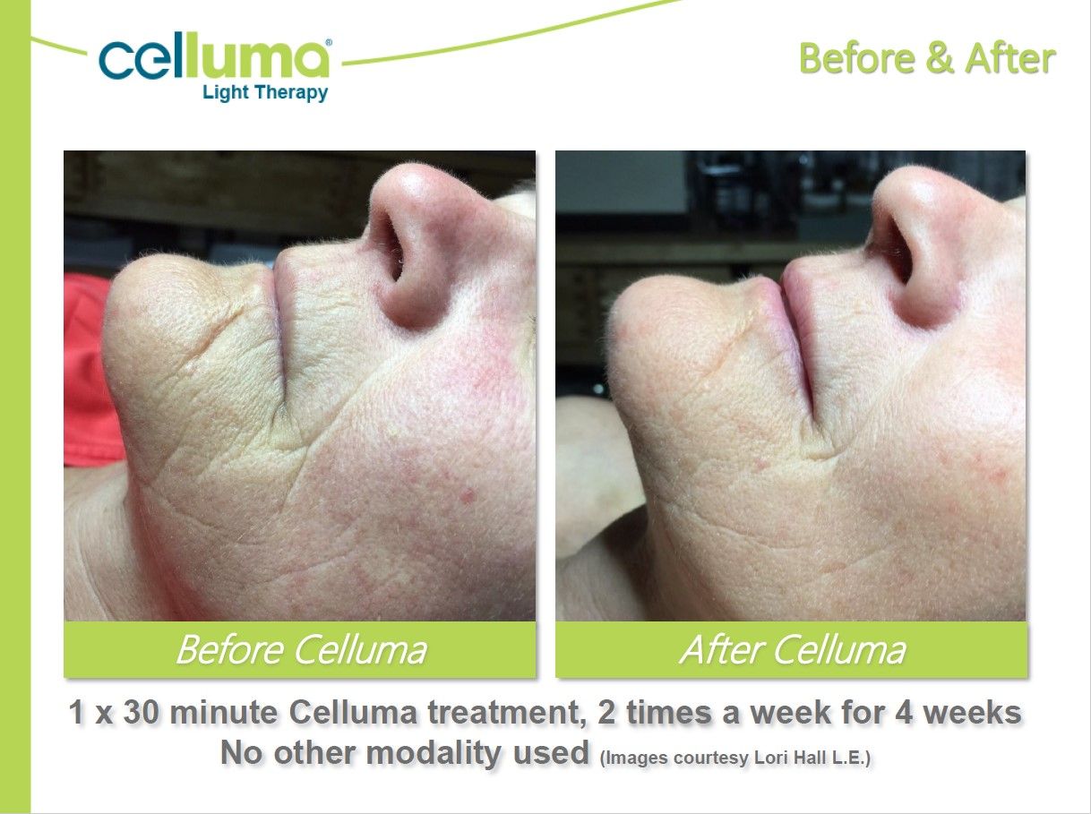 A before and after photo of a woman 's face