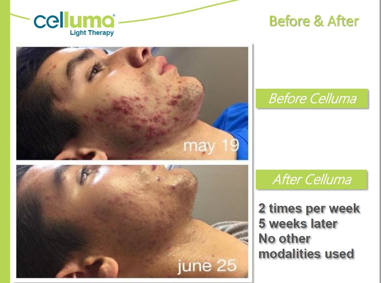 A before and after photo of a man 's face
