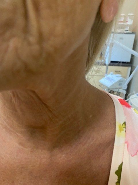Skin texture