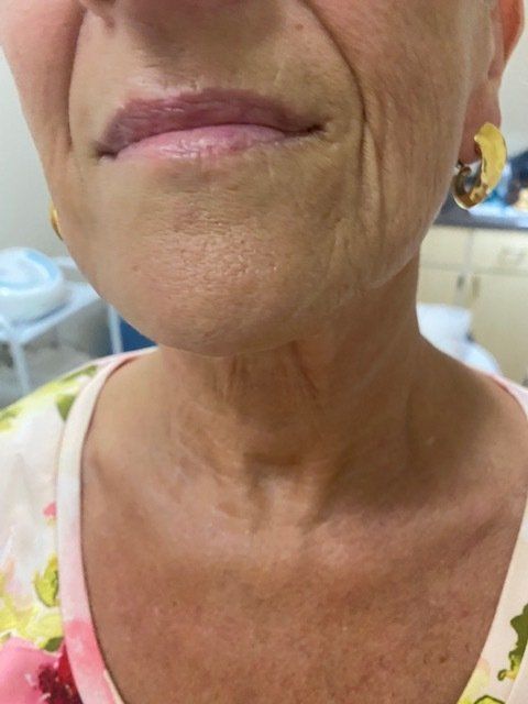 Skin texture