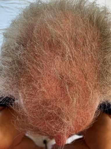A close up of a person 's head with gray hair