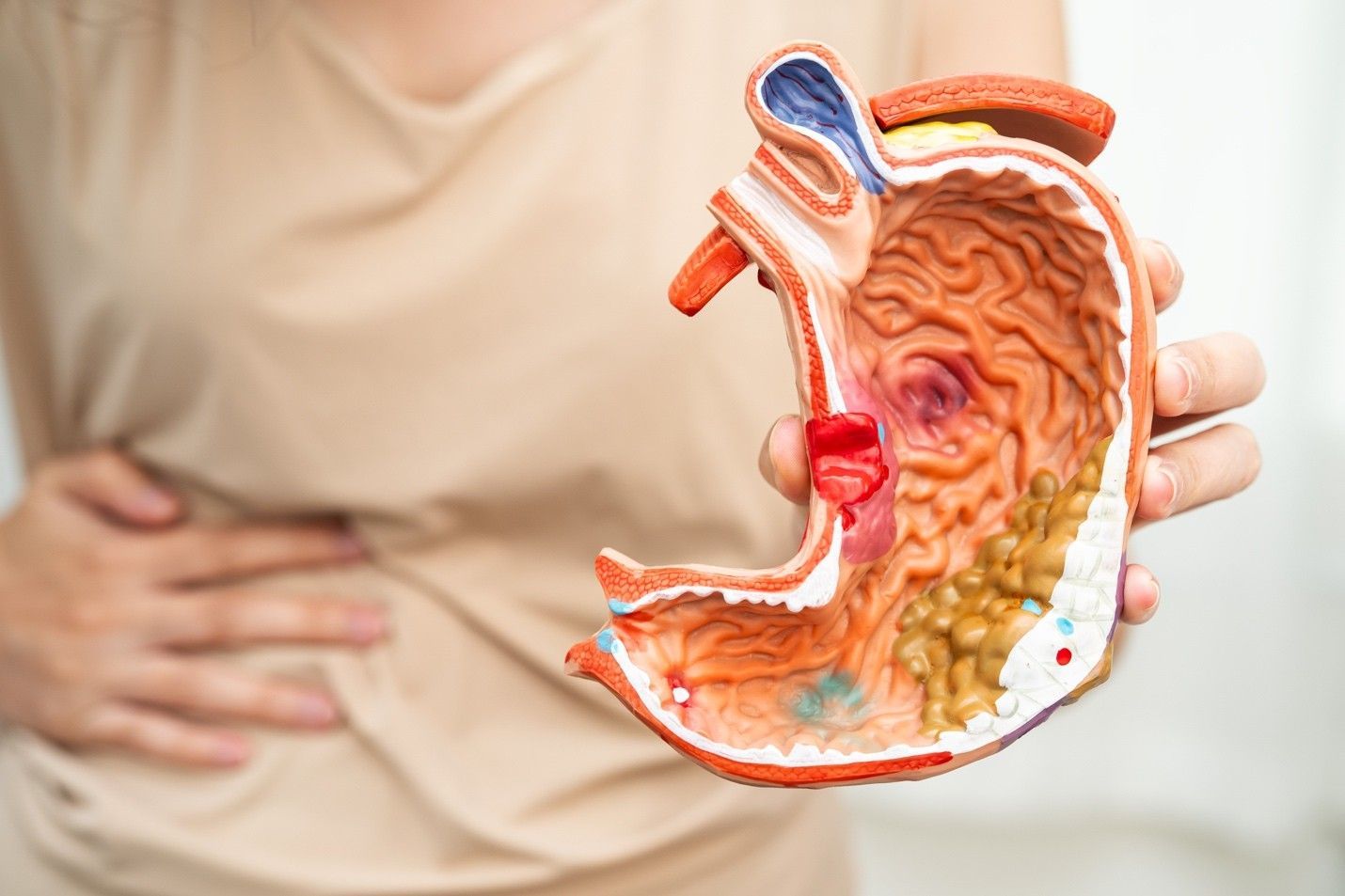 Leaky Gut Syndrome: Myth or Medical Condition?