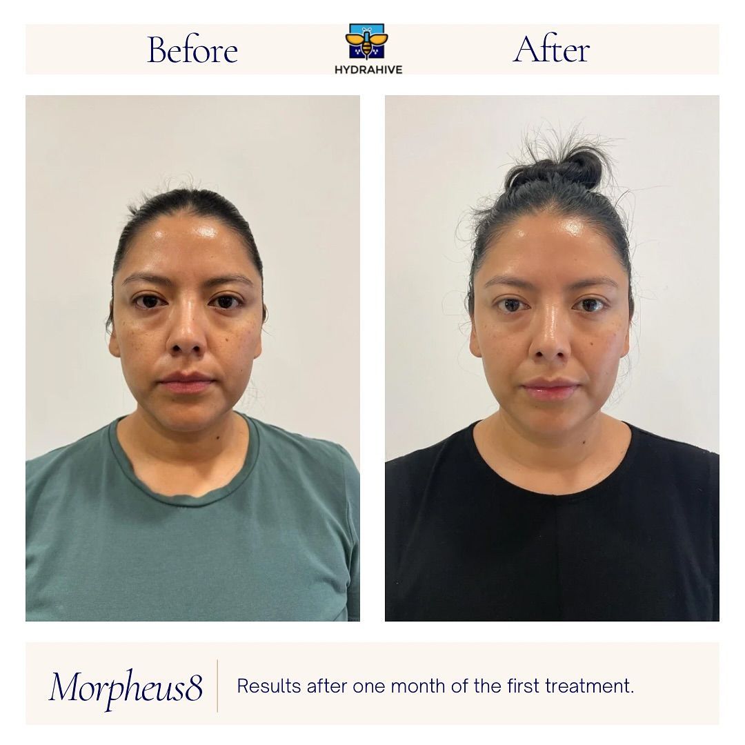 A before and after photo of a woman 's face