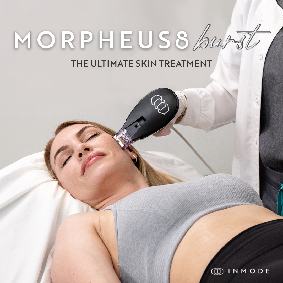 A woman is getting a microneedle treatment on her face.