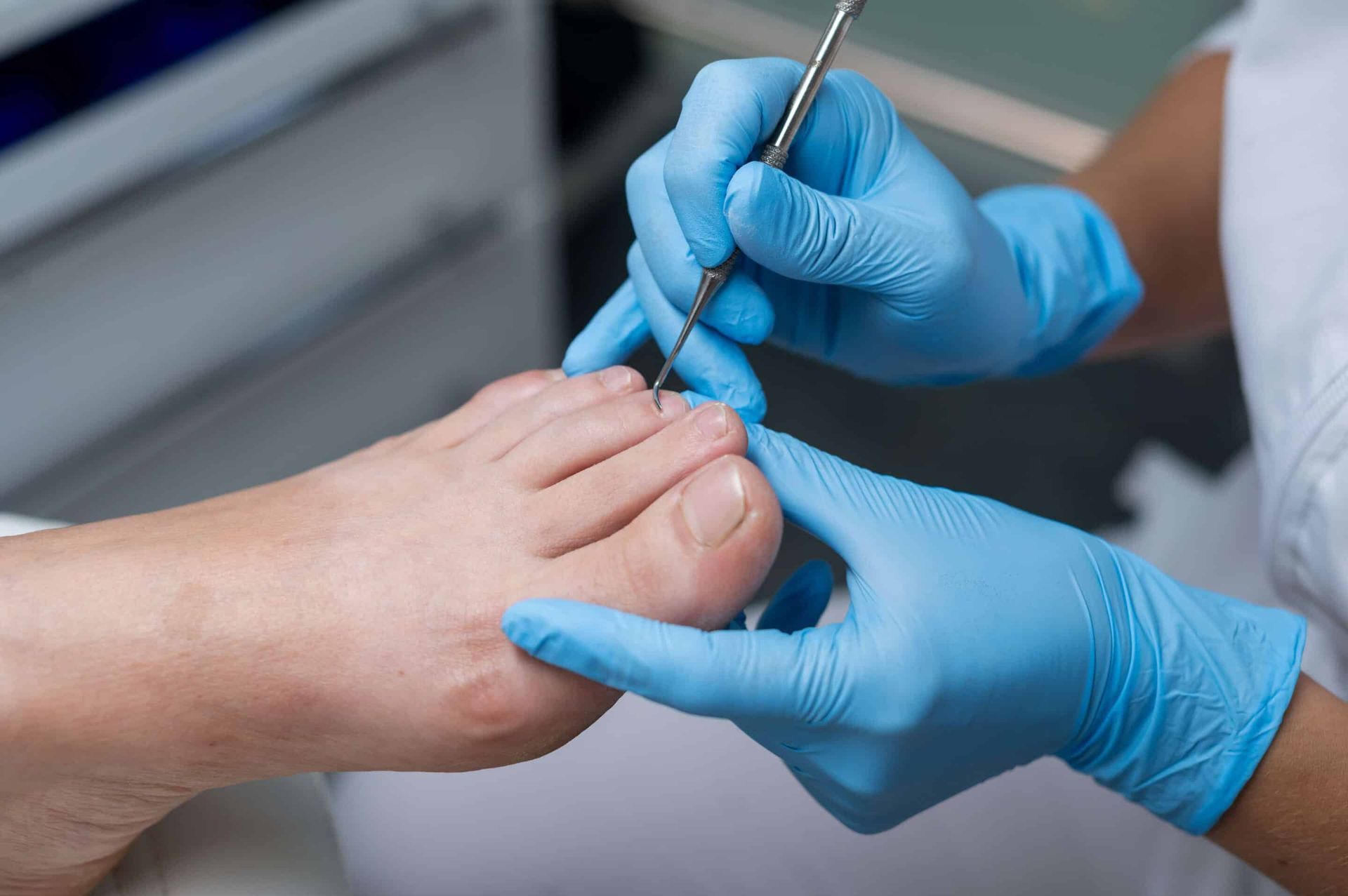 Person's foot being examined with a medical tool by gloved hands.