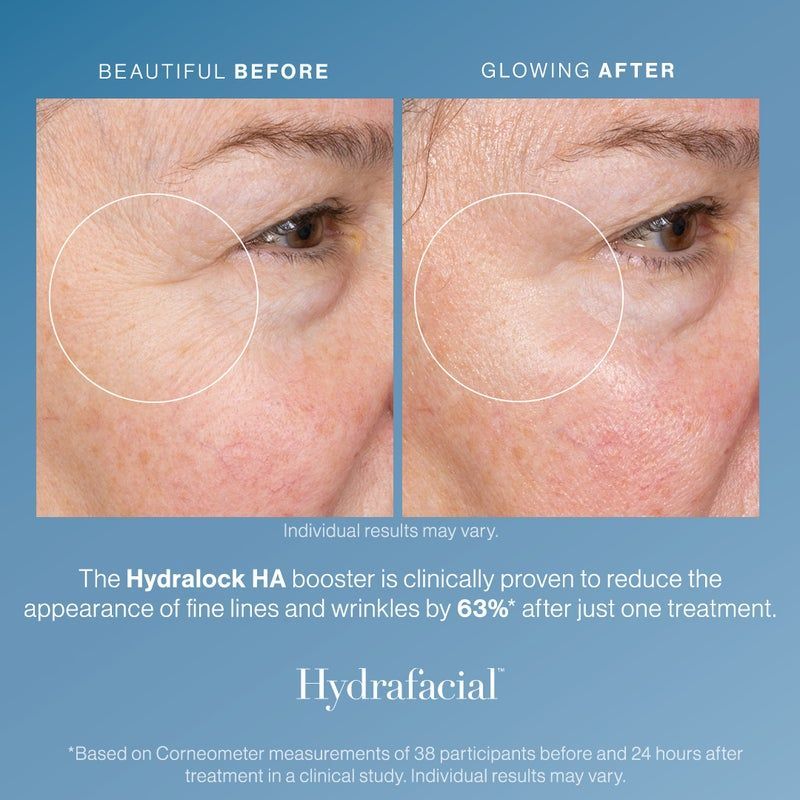 A before and after photo of a woman 's face