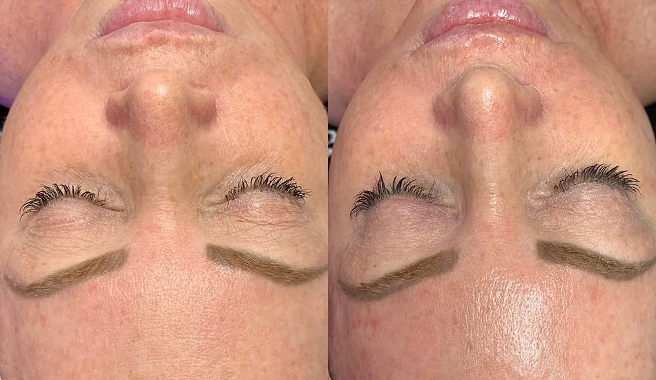 A before and after photo of a woman 's face with her eyes closed.