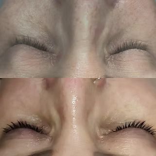 A before and after photo of a woman 's face with her eyes closed.