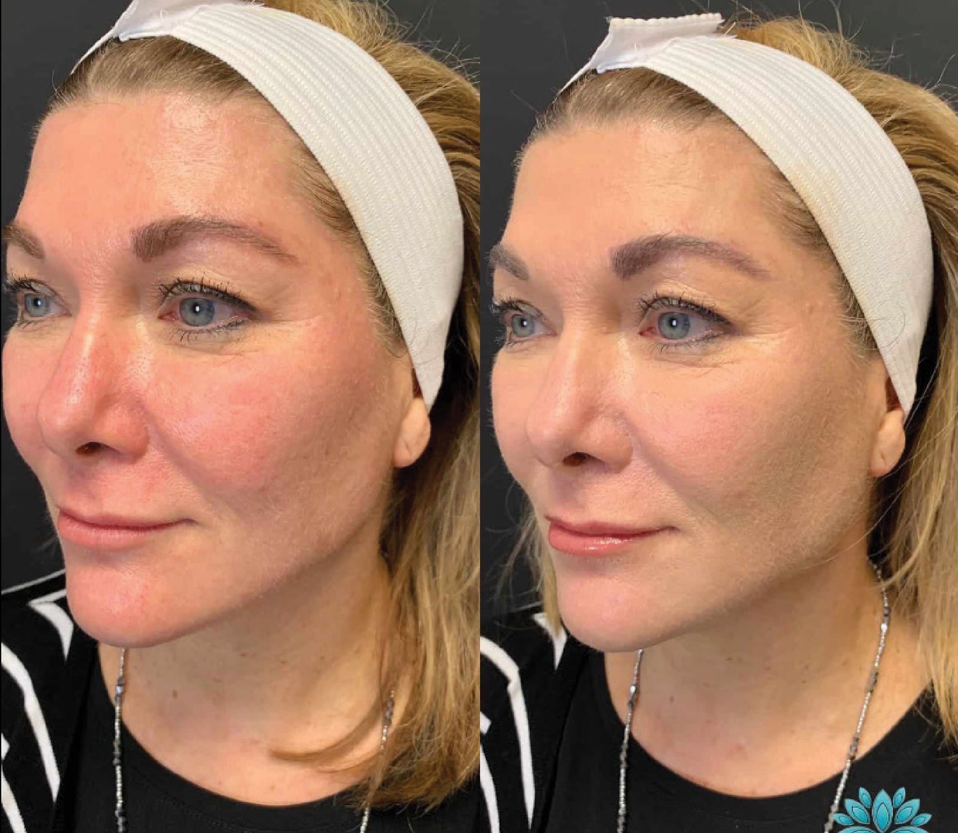 A before and after photo of a woman wearing a headband.