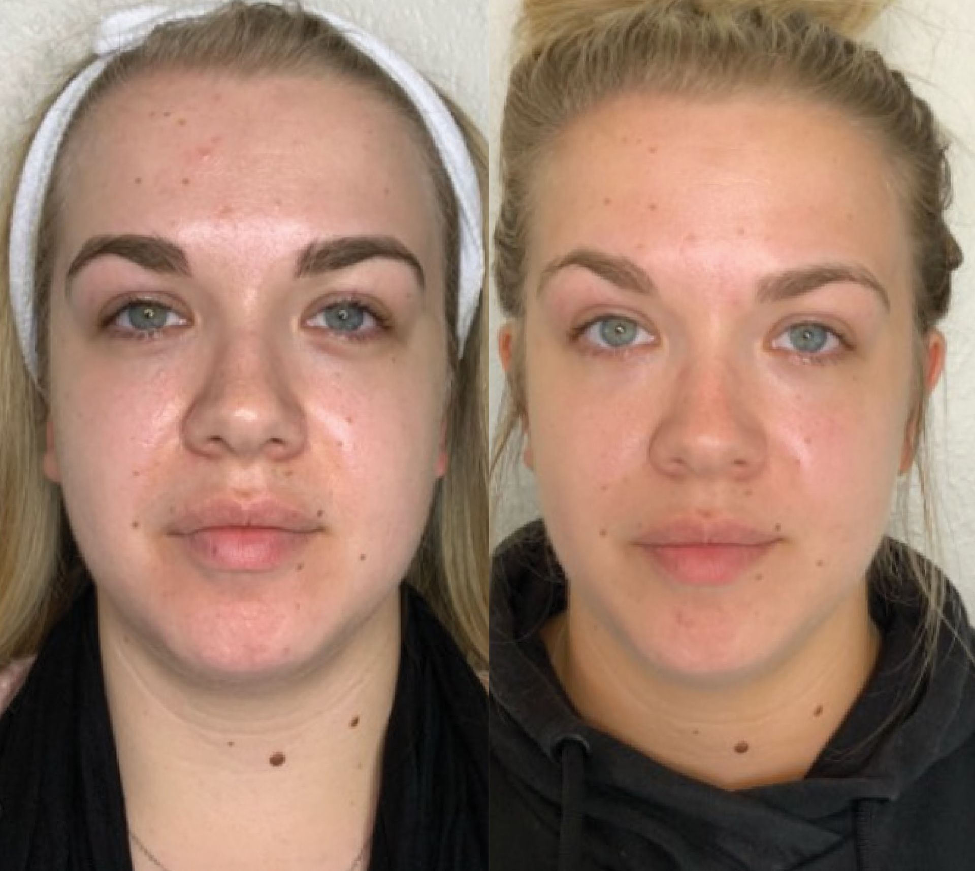 A before and after photo of a woman 's face with and without makeup.